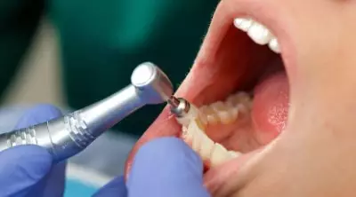 Professionelle Zahnreinigung (PZR)