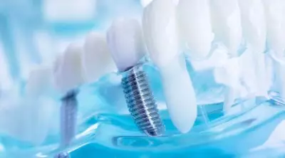 Oralchirurgie (Chirurgie im Mund)